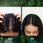 Flake Free Range - Image 6